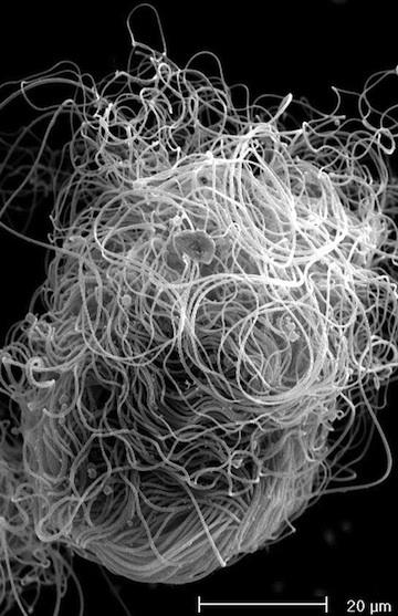 千奇百怪的昆虫精子果蝇精子长6厘米为身体20倍