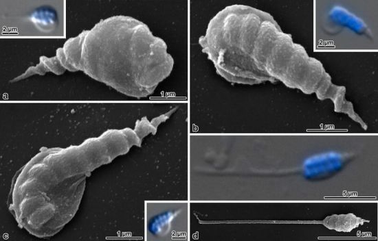 千奇百怪的昆虫精子果蝇精子长6厘米为身体20倍