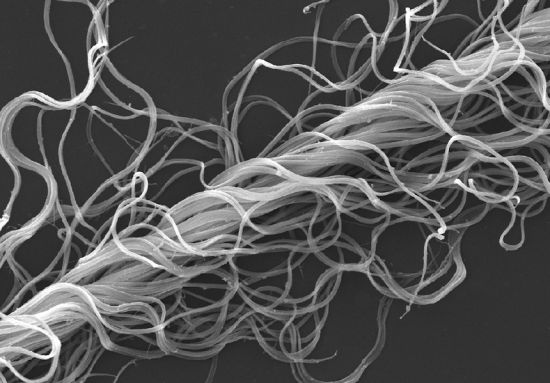 千奇百怪的昆虫精子果蝇精子长6厘米为身体20倍