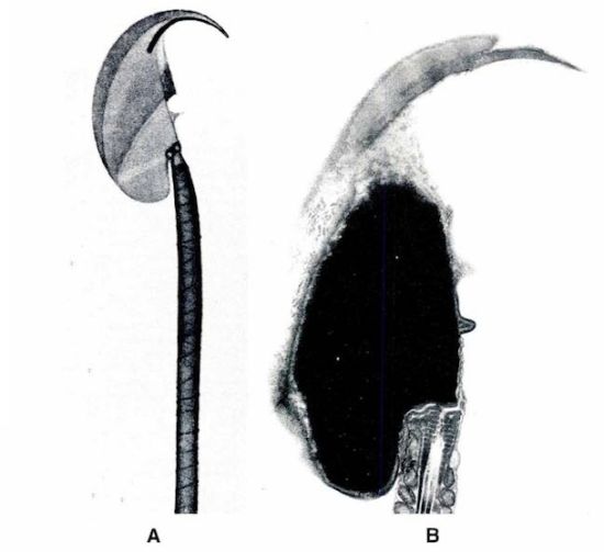 千奇百怪的昆虫精子果蝇精子长6厘米为身体20倍