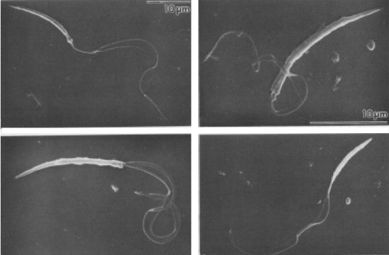 千奇百怪的昆虫精子果蝇精子长6厘米为身体20倍