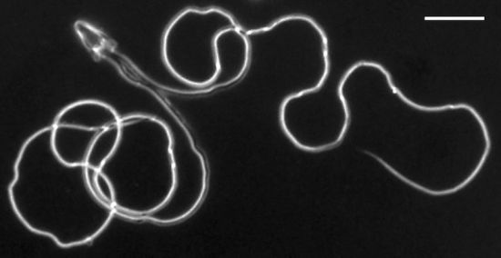 千奇百怪的昆虫精子果蝇精子长6厘米为身体20倍